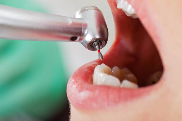 Best Urgent Tooth Repair  in Green, OR